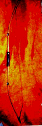 bow2large.gif (36033 bytes)