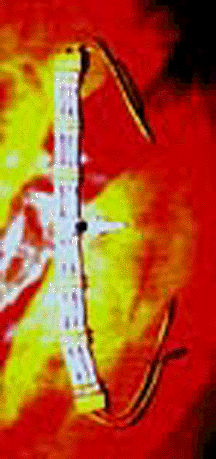 choker1blarge.gif (65071 bytes)